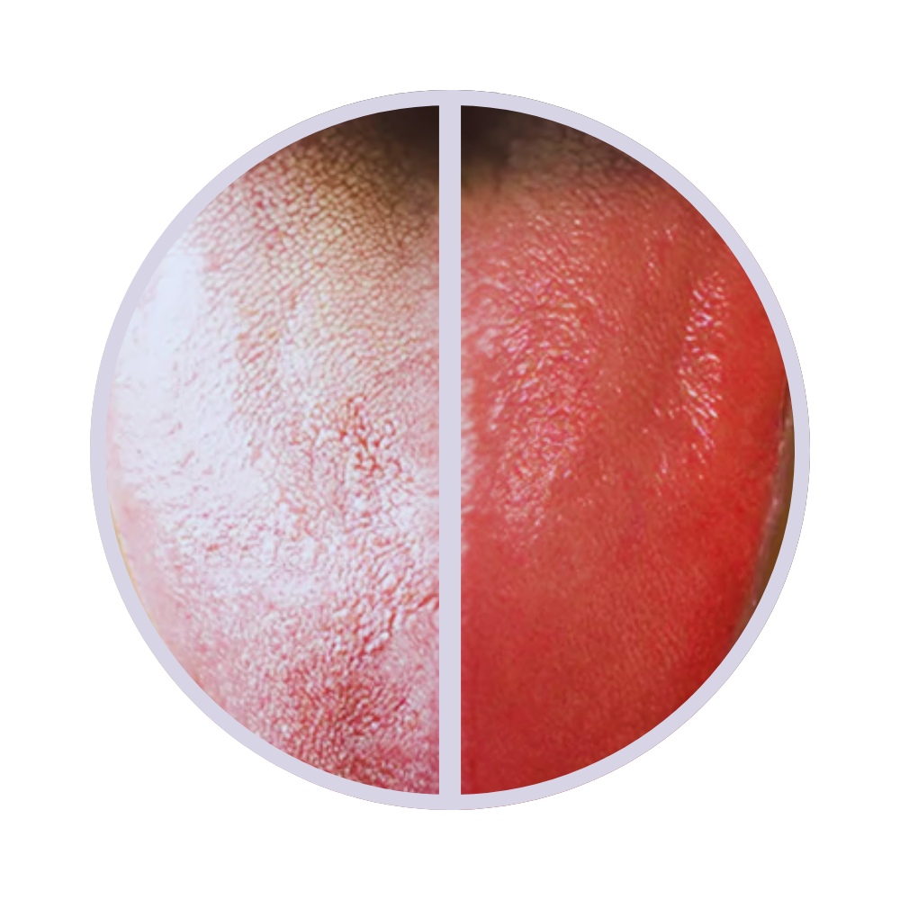 Ivora - Tongue Scraper